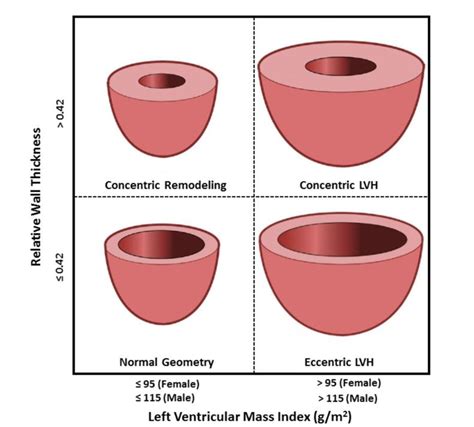 relative wall thickness echo calculator